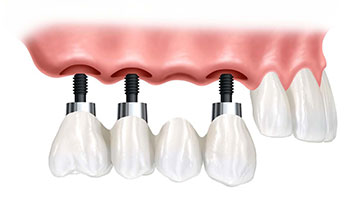odontologia